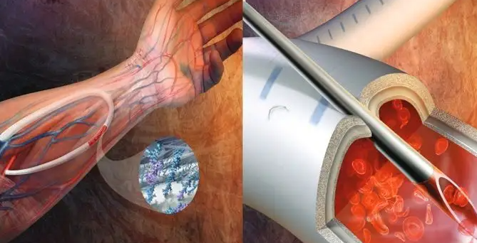 人造血管.png 人造血管.png