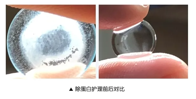 角膜眼鏡.png 角膜眼鏡.png