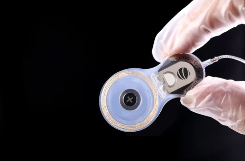 人工耳蝸 人工耳蝸